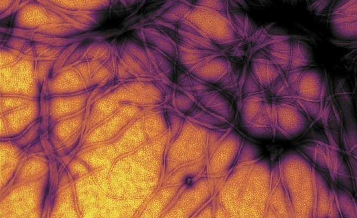 Prion&#x20;protein&#x20;expressed&#x20;in&#x20;E.&#x20;coli,&#x20;purified&#x20;and&#x20;fibrillized&#x20;at&#x20;pH&#x20;7