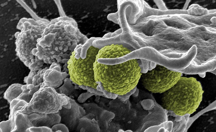 Scanning&#x20;Electron&#x20;Micrograph&#x20;showing&#x20;the&#x20;interaction&#x20;between&#x20;Staphylococcus&#x20;aureus&#x20;&#x28;green&#x29;&#x20;and&#x20;a&#x20;human&#x20;white&#x20;cell