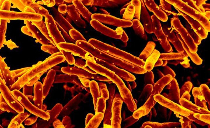 Mycobacterium&#x20;tuberculosis