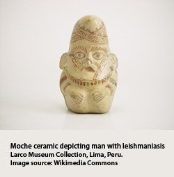 Moche&#x20;ceramic&#x20;of&#x20;man&#x20;with&#x20;leishmaniasis,&#x20;Larco&#x20;museum&#x20;collection,&#x20;Peru