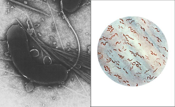 Vibrio&#x20;cholerae,&#x20;as&#x20;seen&#x20;under&#x20;light&#x20;microscope&#x20;&#x28;Right,&#x20;By&#x20;CDC&#x20;&#x5B;Public&#x20;domain&#x5D;&#x29;,&#x20;or&#x20;by&#x20;transmission&#x20;electron&#x20;microscope&#x20;&#x28;Left,&#x20;By&#x20;Tom&#x20;Kirn,&#x20;Ron&#x20;Taylor,&#x20;Louisa&#x20;Howard&#x20;-&#x20;Dartmouth&#x20;Electron&#x20;Microscope&#x20;Facility&#x5B;Public&#x20;domain&#x5D;&#x29;,&#x20;via&#x20;Wikimedia&#x20;Commons