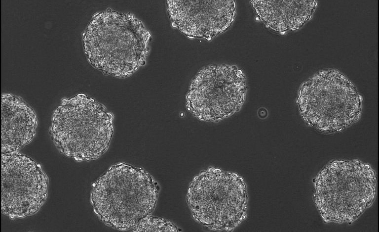 Phase&#x20;image&#x20;of&#x20;embryoid&#x20;bodies&#x20;&#x28;EBs&#x29;&#x20;formed&#x20;from&#x20;mouse&#x20;embryonic&#x20;stem&#x20;cells