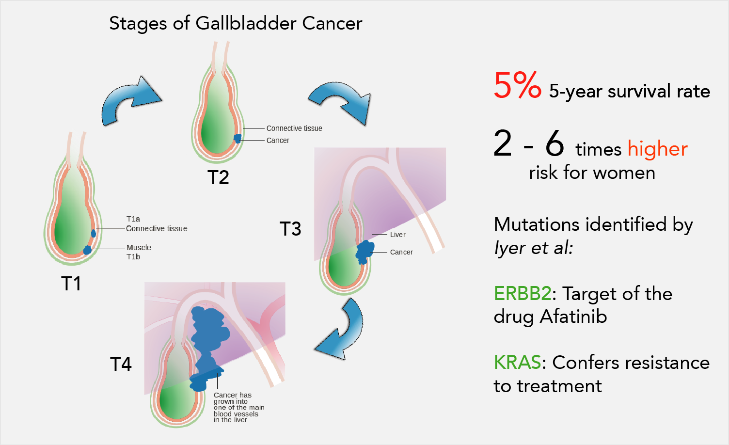 Towards&#x20;personalized&#x20;therapy&#x20;for&#x20;Indian&#x20;gallbladder&#x20;cancer&#x20;patients