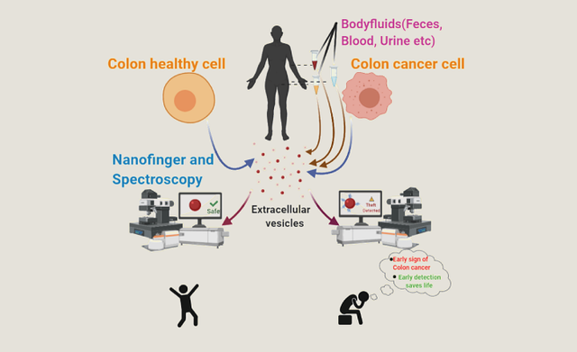 A Nanosized Tool To Non-invasively Detect Cancer Cells - IndiaBioscience