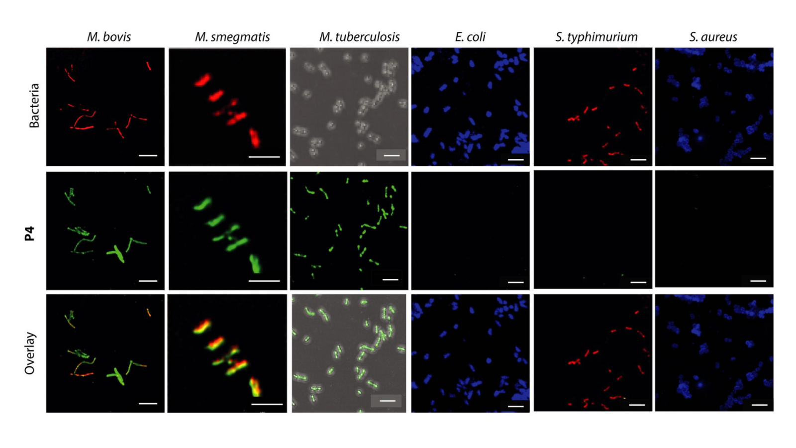 CA-derived&#x20;fluorescent&#x20;probe&#x20;P4&#x20;specifically&#x20;stains&#x20;mycobacterial&#x20;strains,&#x20;as&#x20;visible&#x20;in&#x20;the&#x20;fluorescence&#x20;micrographs&#x20;of&#x20;P4-labeled&#x20;fluorescent&#x20;E.&#x20;coli,&#x20;S.&#x20;typhimurium,&#x20;S.&#x20;aureus,&#x20;M.&#x20;smegmatis,&#x20;M.&#x20;bovis,&#x20;and&#x20;non-fluorescent&#x20;M.&#x20;tuberculosis&#x3B;&#x20;scale&#x20;&#x3D;&#x20;5&#x20;&#x03BC;m