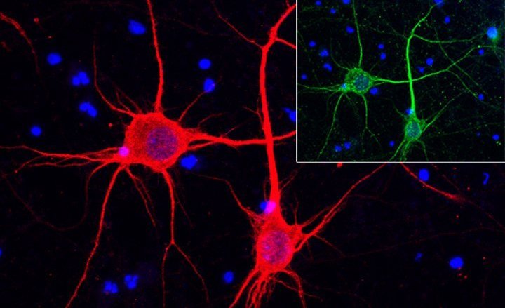 Cultured&#x20;cortical&#x20;neurons&#x20;marked&#x20;by&#x20;the&#x20;cytoskeletal&#x20;protein&#x20;MAP2&#x20;&#x28;red&#x29;&#x3B;&#x20;Inset&#x3A;&#x20;Neuronal&#x20;mitochondria&#x20;marked&#x20;by&#x20;the&#x20;mitochondrial&#x20;membrane&#x20;protein&#x20;VDAC&#x20;&#x28;green&#x29;