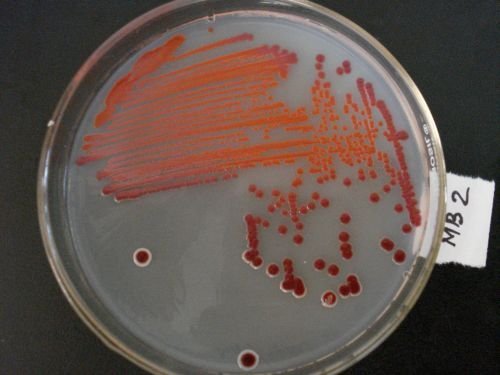 Serratia&#x20;marcescens