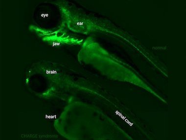 CHD7-expressing&#x20;cells&#x20;in&#x20;normal&#x20;&#x28;top&#x29;&#x20;and&#x20;&#x27;diseased&#x27;&#x20;&#x28;bottom&#x29;&#x20;Zebrafish