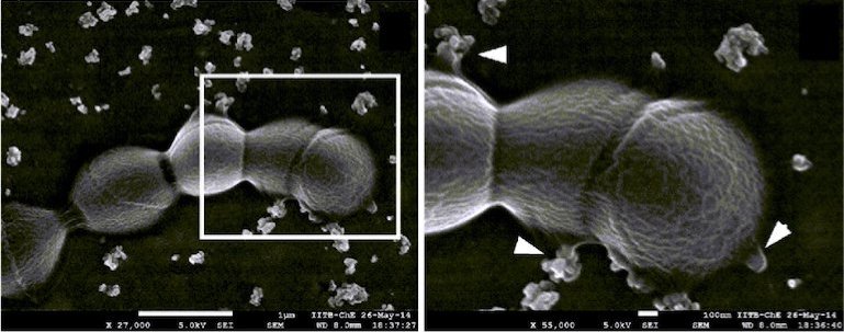 SEM&#x20;image&#x20;of&#x20;GBS&#x20;strain&#x20;exhibiting&#x20;aggregated&#x20;MVs.&#x20;Zoomed&#x20;in&#x20;view&#x20;of&#x20;the&#x20;boxed&#x20;area&#x20;from&#x20;left.&#x20;Arrowheads&#x20;indicate&#x20;vesicles&#x20;budding&#x20;sites.&#x20;Scale&#x20;bar&#x3B;&#x20;100&#x20;nm.&#x20;