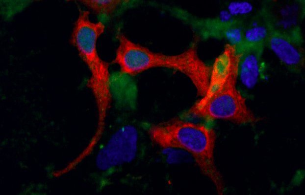 Representation&#x20;of&#x20;localisation&#x20;of&#x20;GPCRs&#x20;&#x28;green&#x29;&#x20;and&#x20;arrestin&#x20;&#x28;red&#x29;&#x20;and&#x20;the&#x20;nucleus&#x20;of&#x20;cells&#x20;&#x28;blue&#x29;.