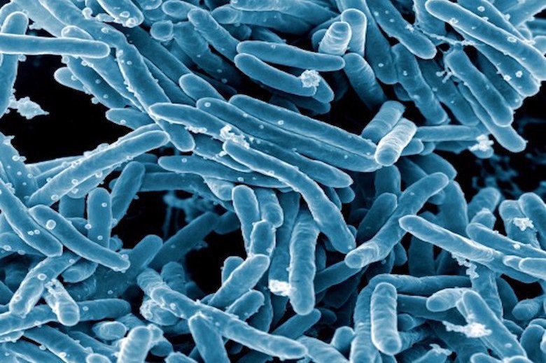 &#x20;Mycobacterium&#x20;tuberculosis&#x20;Bacteria