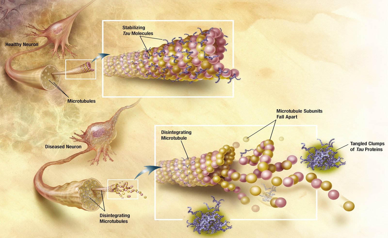 Morphology&#x20;of&#x20;normal&#x20;and&#x20;diseased&#x20;Tau