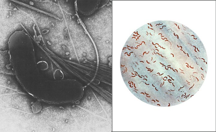 Холерный вибрион фото под микроскопом