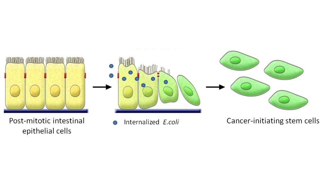Aberrant internalisation of non-pathogenic gut E.coli expands cancer stem cell population and causes higher malignancy in colorectal cancer.