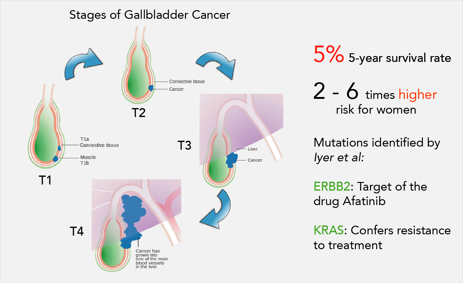 Gall bladder cancer