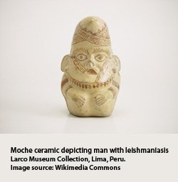 Moche ceramic of man with leishmaniasis, Larco museum collection, Peru