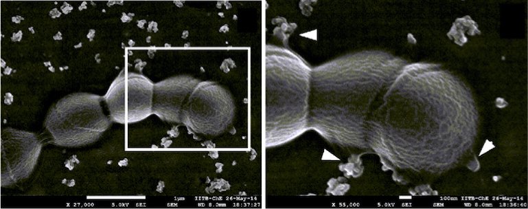 SEM image of GBS strain exhibiting aggregated MVs. Zoomed in view of the boxed area from left. Arrowheads indicate vesicles budding sites. Scale bar; 100 nm.