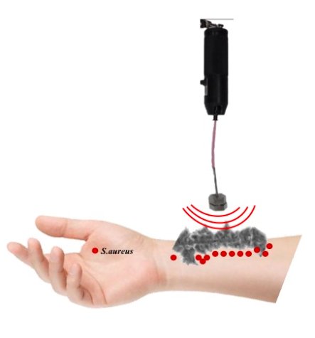 Model remote trigger crop