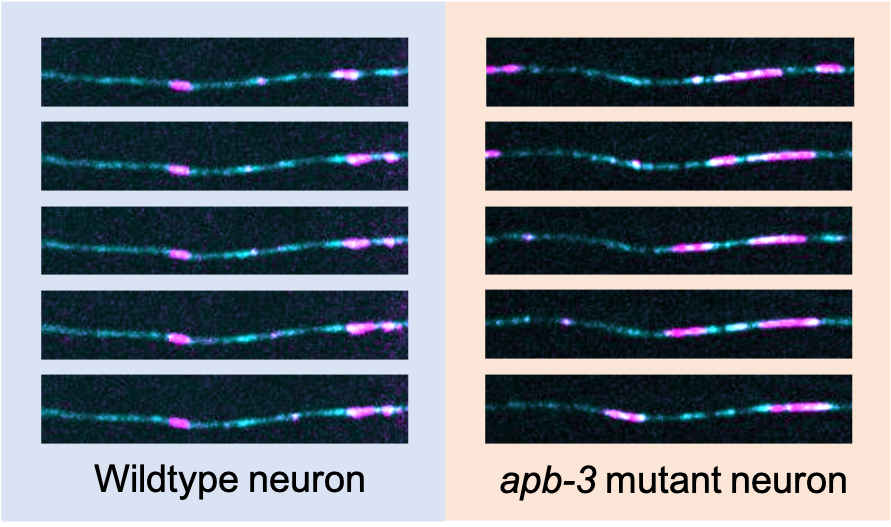 An image showing various time points in an axon with moving vesicles. Blue is synaptic vesicles, pink is lysosomes, and white means the overlap between them. Each strip depicts the same region ~10 to 20 seconds apart. There are fewer white regions in wildtype neurons, compared to the apb-3 mutant neurons. Photo Credit: Koushika Lab.