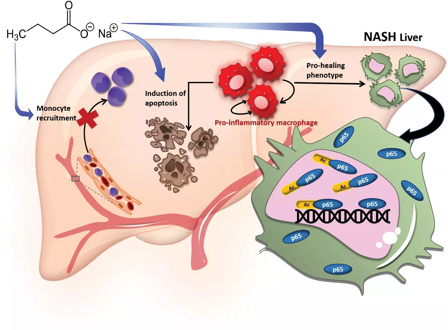 Schematic of the mechanism of NaBu (Sodium Butyrate) in improving non-alcoholic steatohepatitis (NASH). Image published under Creative Commons CC BY license