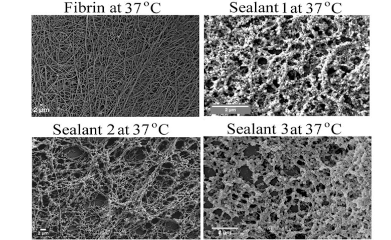 Effect of sealants (lab-made coagulants) on blood clotting in comparison to fibrin