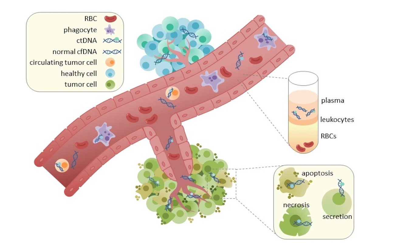 Circulating tumor DNA (ctDNA) is found in serum and plasma fractions from blood