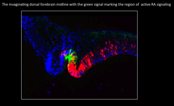 Picture of chick dorsal forebrain midline