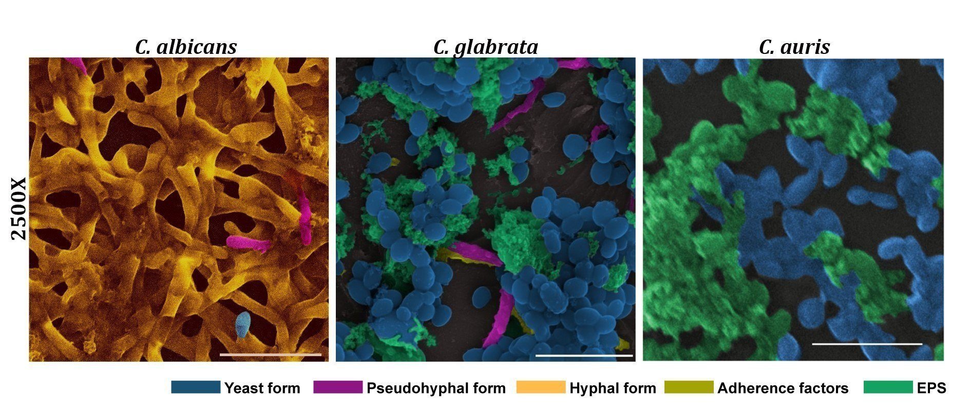Architecture of the biofilm formed by the cells of three different pathogenic Candida species on gelatin-coated coverslips as captured under scanning electron microscopy (Scale bar: 30µm).