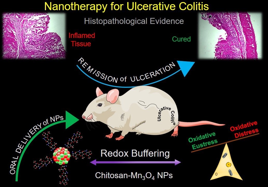 Nanotherapy for Ulcerative Colitis. Picture Credits: Samir Kumar Pal's Lab.